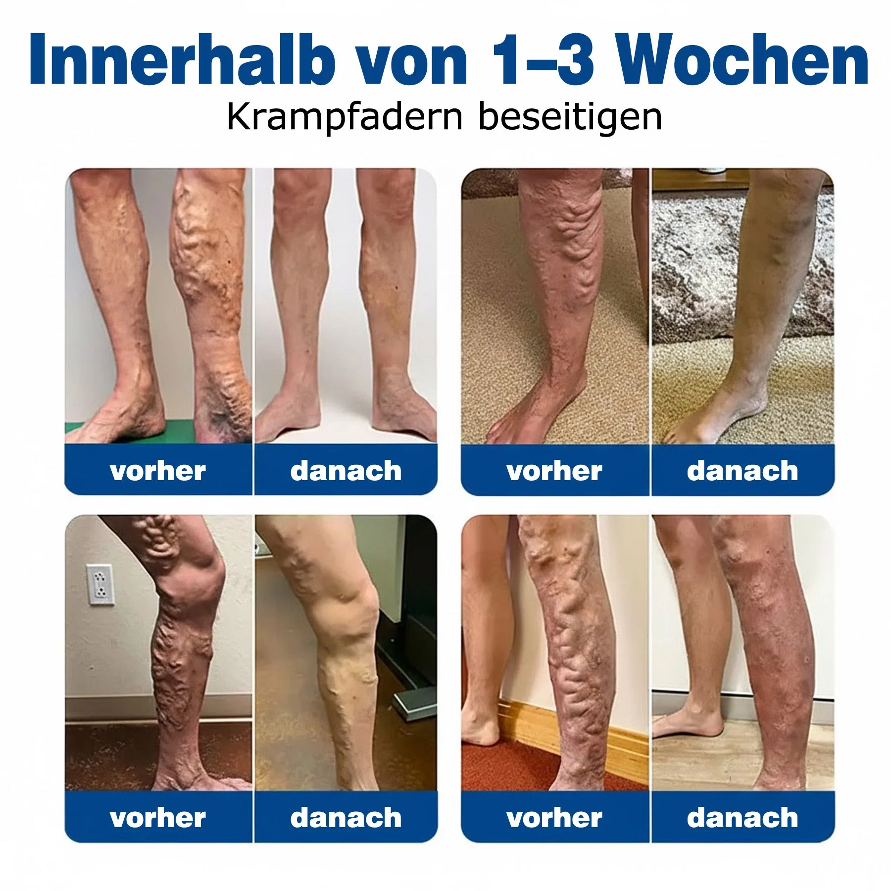🇩🇪🔥 𝗚𝗙𝗢𝗨𝗞® 𝗩𝗲𝗶𝗻𝗧𝗮𝗿𝗴𝗲𝘁 𝗠𝗶𝗸𝗿𝗼𝗻𝗮𝗱𝗲𝗹-𝗣𝗳𝗹𝗮𝘀𝘁𝗲𝗿 ✅ 𝗦𝗼𝗳𝗼𝗿𝘁𝗶𝗴𝗲 𝗟𝗶𝗻𝗱𝗲𝗿𝘂𝗻𝗴, 𝗟𝗮𝗻𝗴𝗳𝗿𝗶𝘀𝘁𝗶𝗴𝗲 𝗘𝗿𝗴𝗲𝗯𝗻𝗶𝘀𝘀𝗲 - Image 3