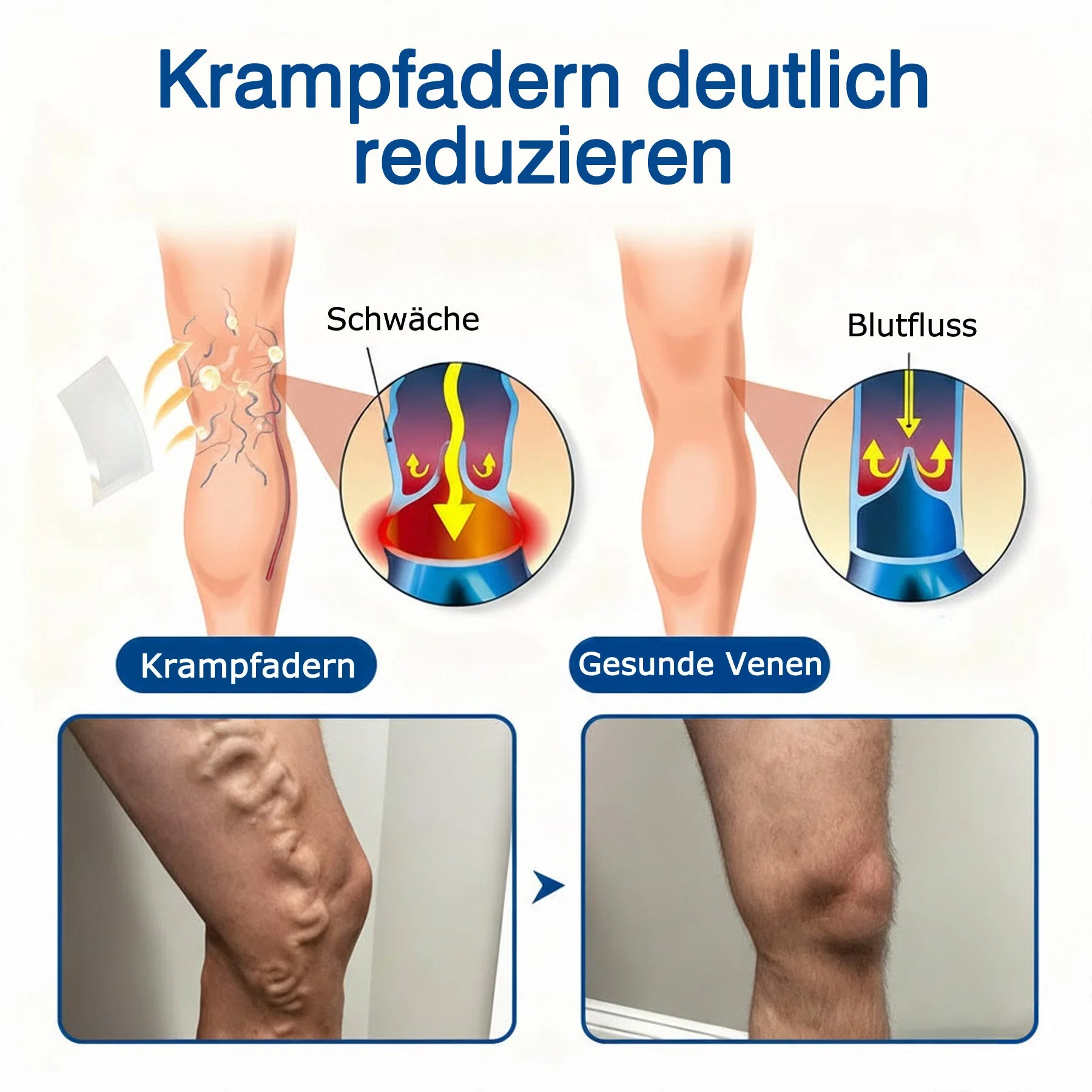 🇩🇪🔥 𝗚𝗙𝗢𝗨𝗞® 𝗩𝗲𝗶𝗻𝗧𝗮𝗿𝗴𝗲𝘁 𝗠𝗶𝗸𝗿𝗼𝗻𝗮𝗱𝗲𝗹-𝗣𝗳𝗹𝗮𝘀𝘁𝗲𝗿 ✅ 𝗦𝗼𝗳𝗼𝗿𝘁𝗶𝗴𝗲 𝗟𝗶𝗻𝗱𝗲𝗿𝘂𝗻𝗴, 𝗟𝗮𝗻𝗴𝗳𝗿𝗶𝘀𝘁𝗶𝗴𝗲 𝗘𝗿𝗴𝗲𝗯𝗻𝗶𝘀𝘀𝗲 - Image 4